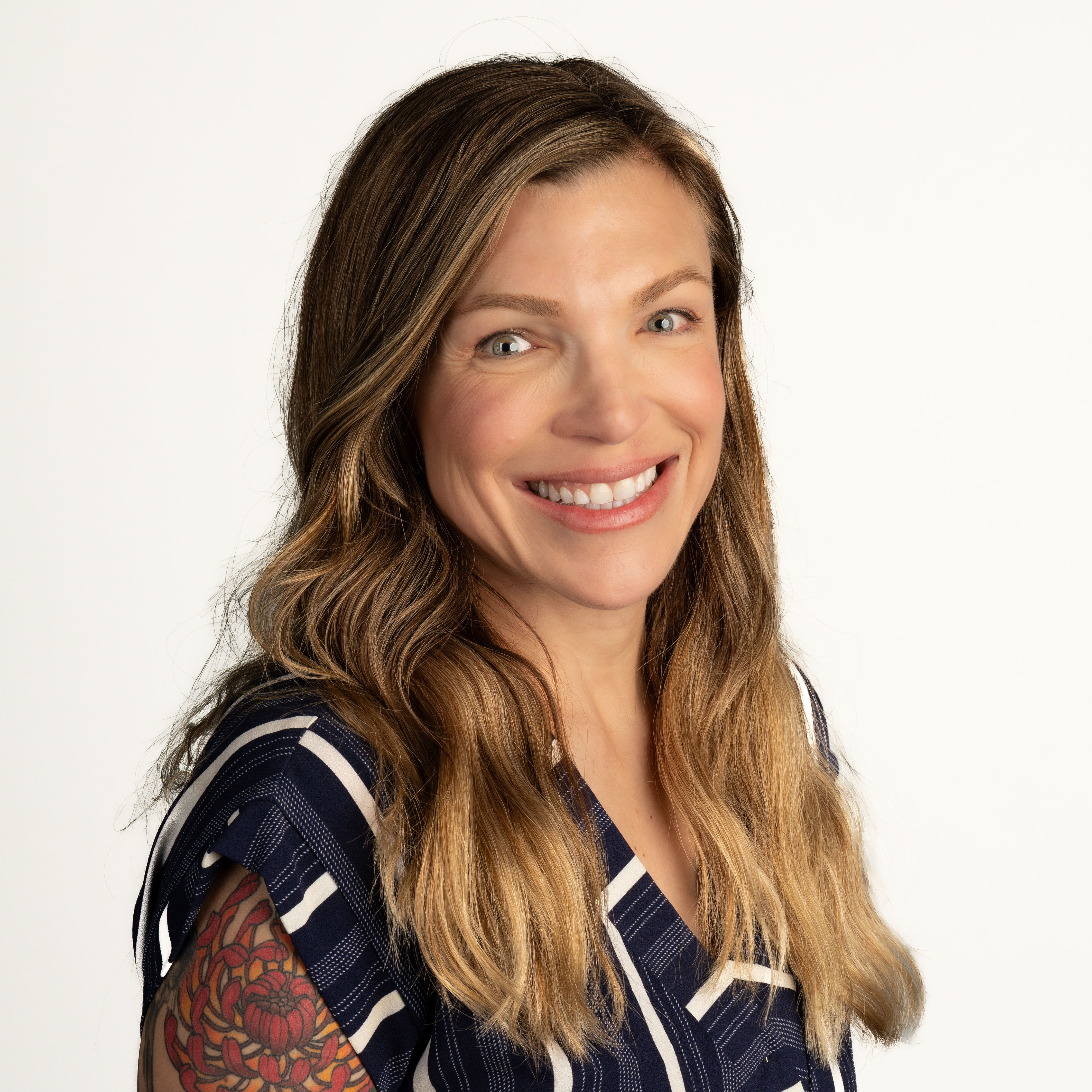 Why I Recommend OPUS Plasma Over Traditional Laser Skin Resurfacing--Every Time