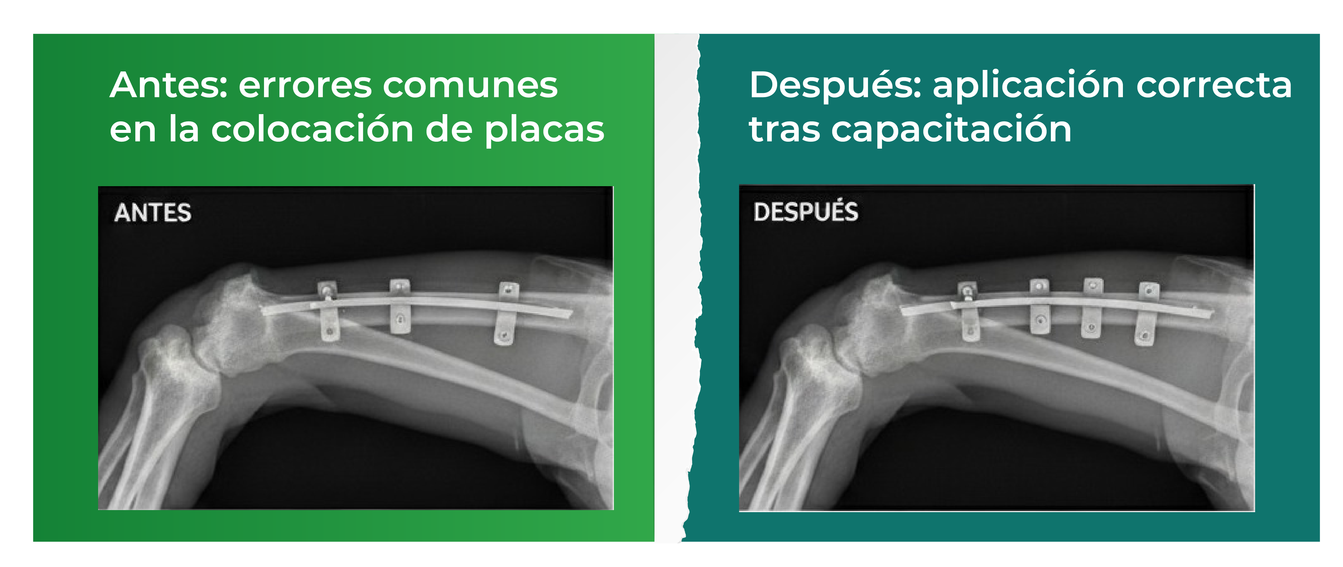 Antes y después - Técnicas correctas de osteosíntesis