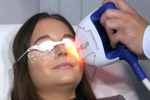 tearing dry eyes treatment london city tearing dry eyes treatment london city