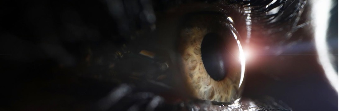 Watery Eyes Unveiled: A Comprehensive Journey into Symptoms, Causes, and Expert Solutions