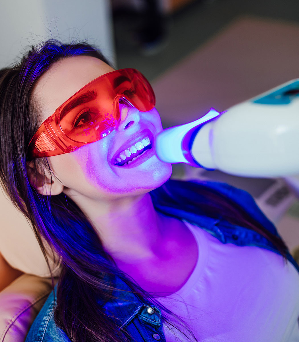 Traditional Braces