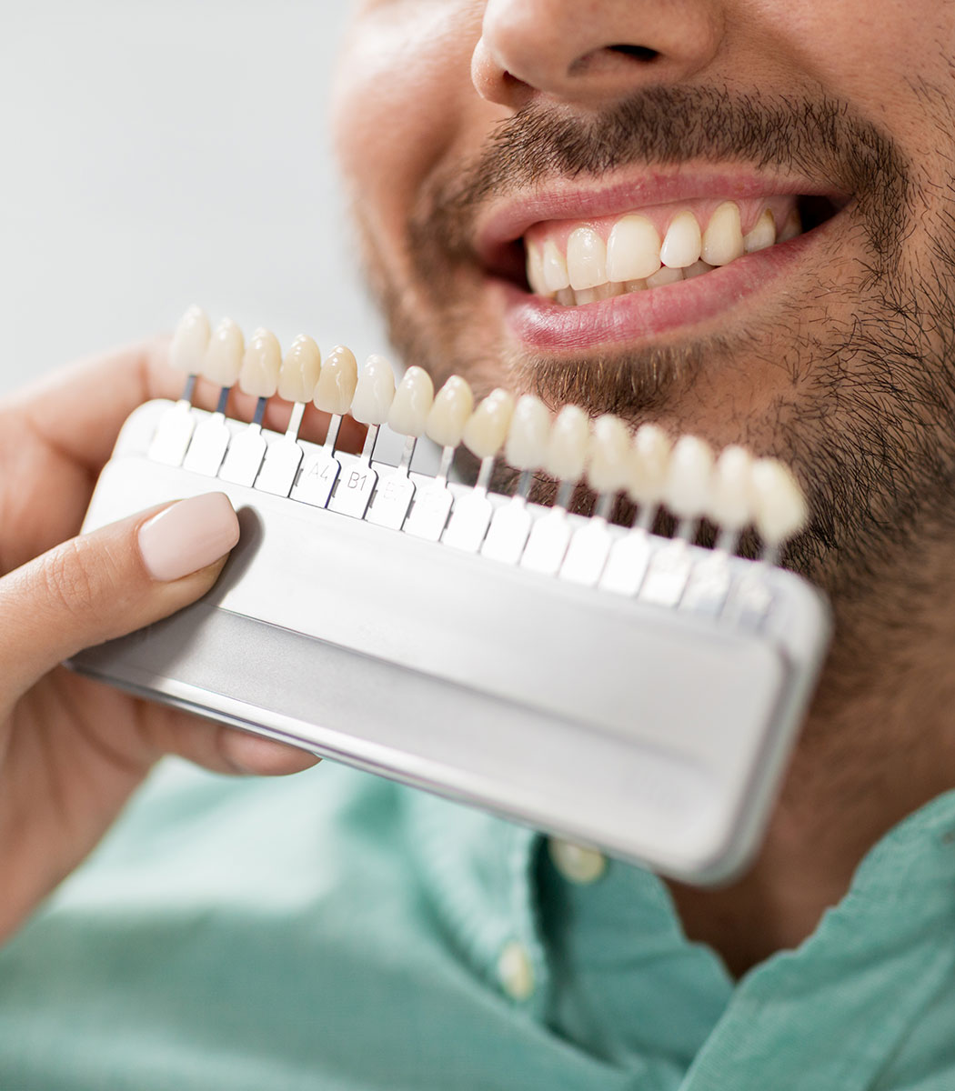 Clear Ceramic Braces