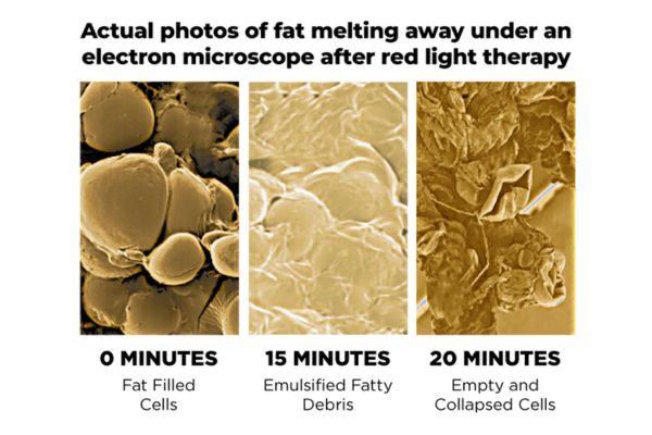 how red light therapy works for weight loss