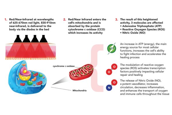 red light therapy overview