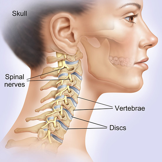 Pain in the neck
