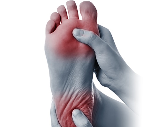 The role of Physical Therapy in Managing Pain Associated with Peripheral Neuropathy