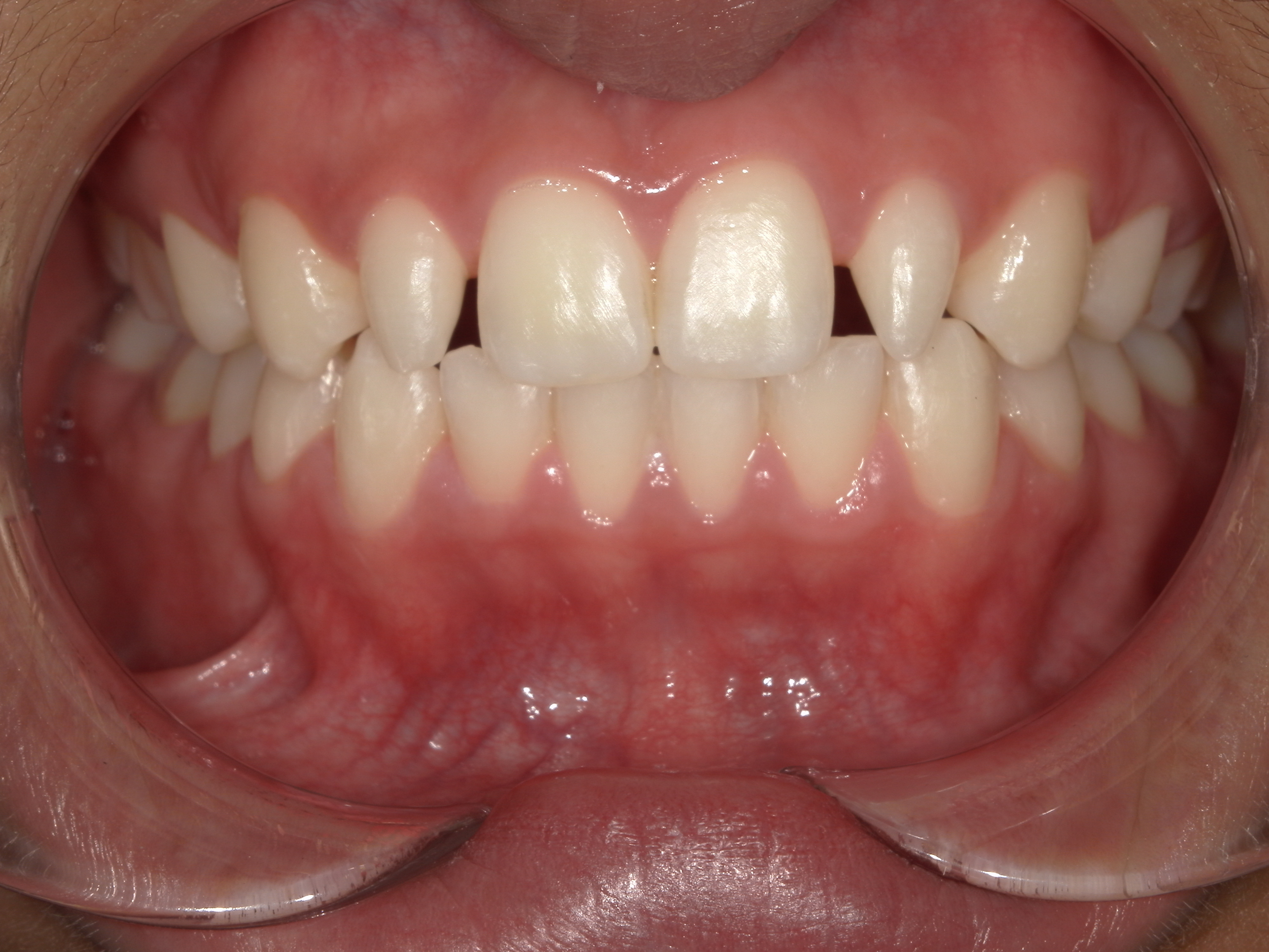 Case 1 Before