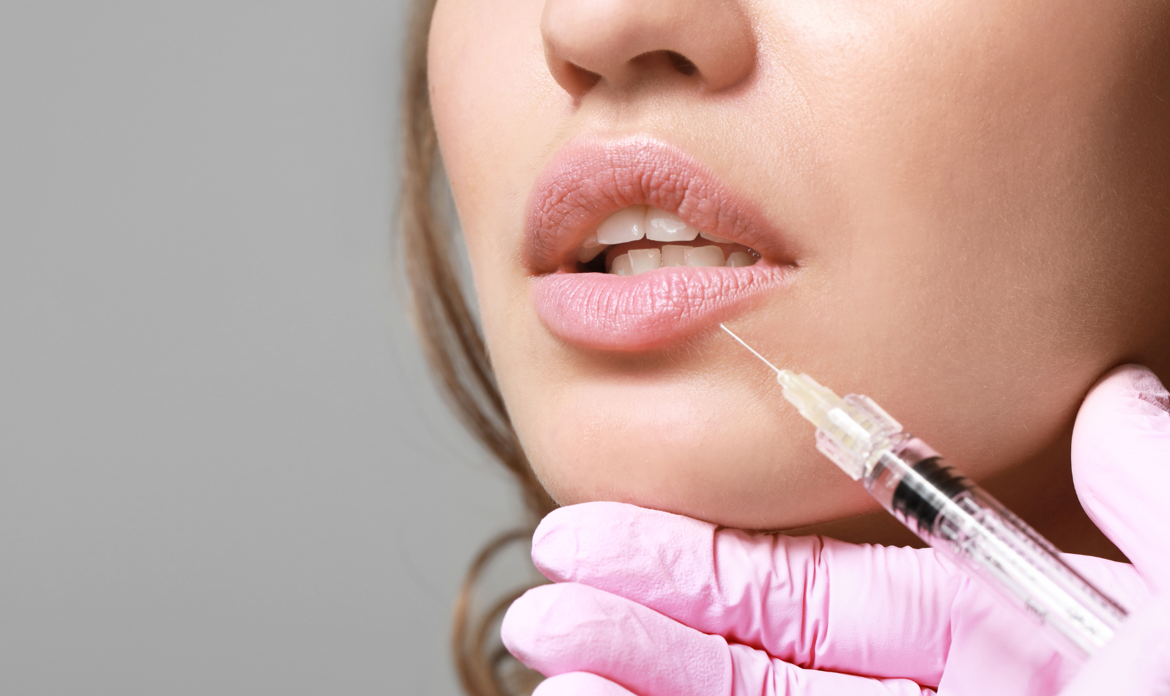 Dermal Fillers