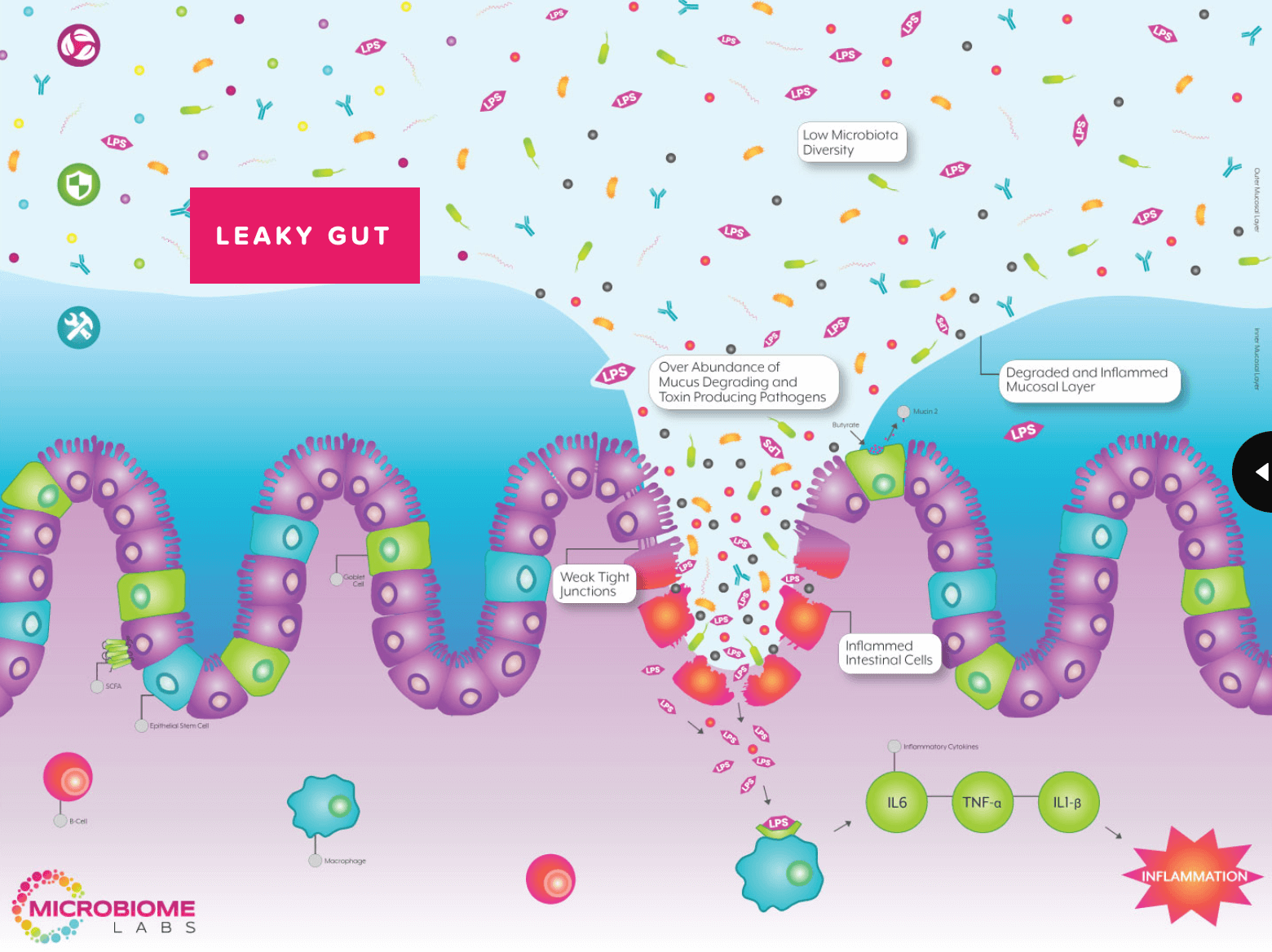 Leaky Gut