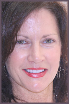 Patient Photo