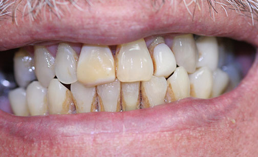 After Smile