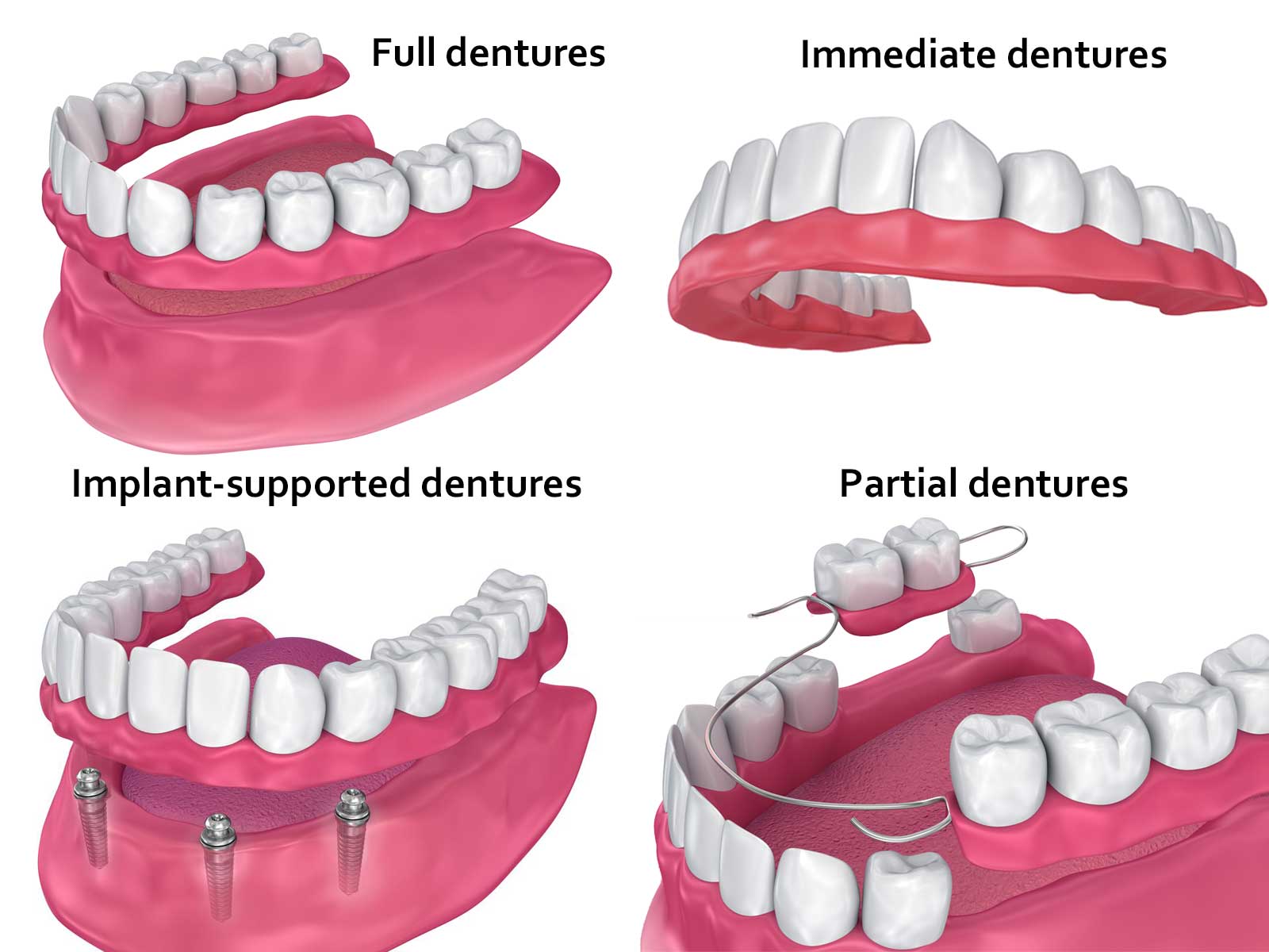 Different kind of dentures on display