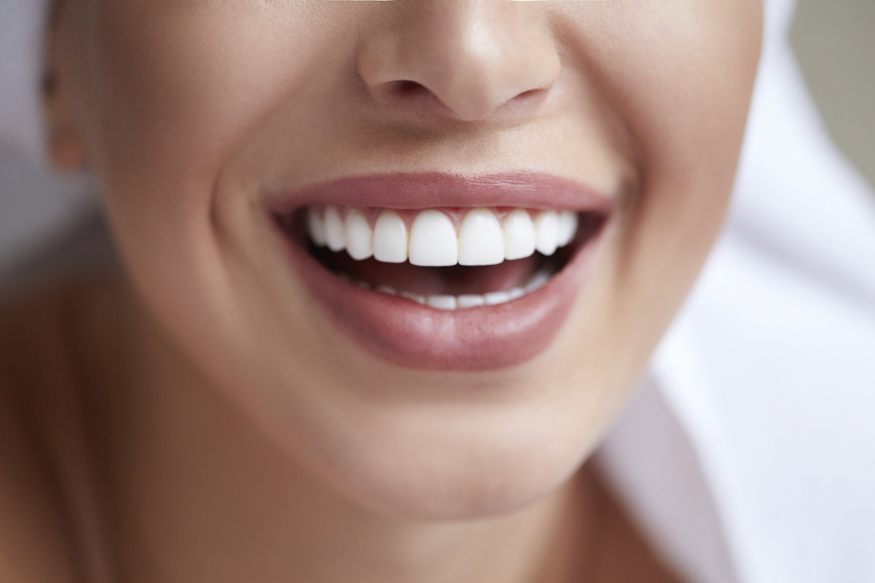 woman beautiful smile after composite bonding treatment