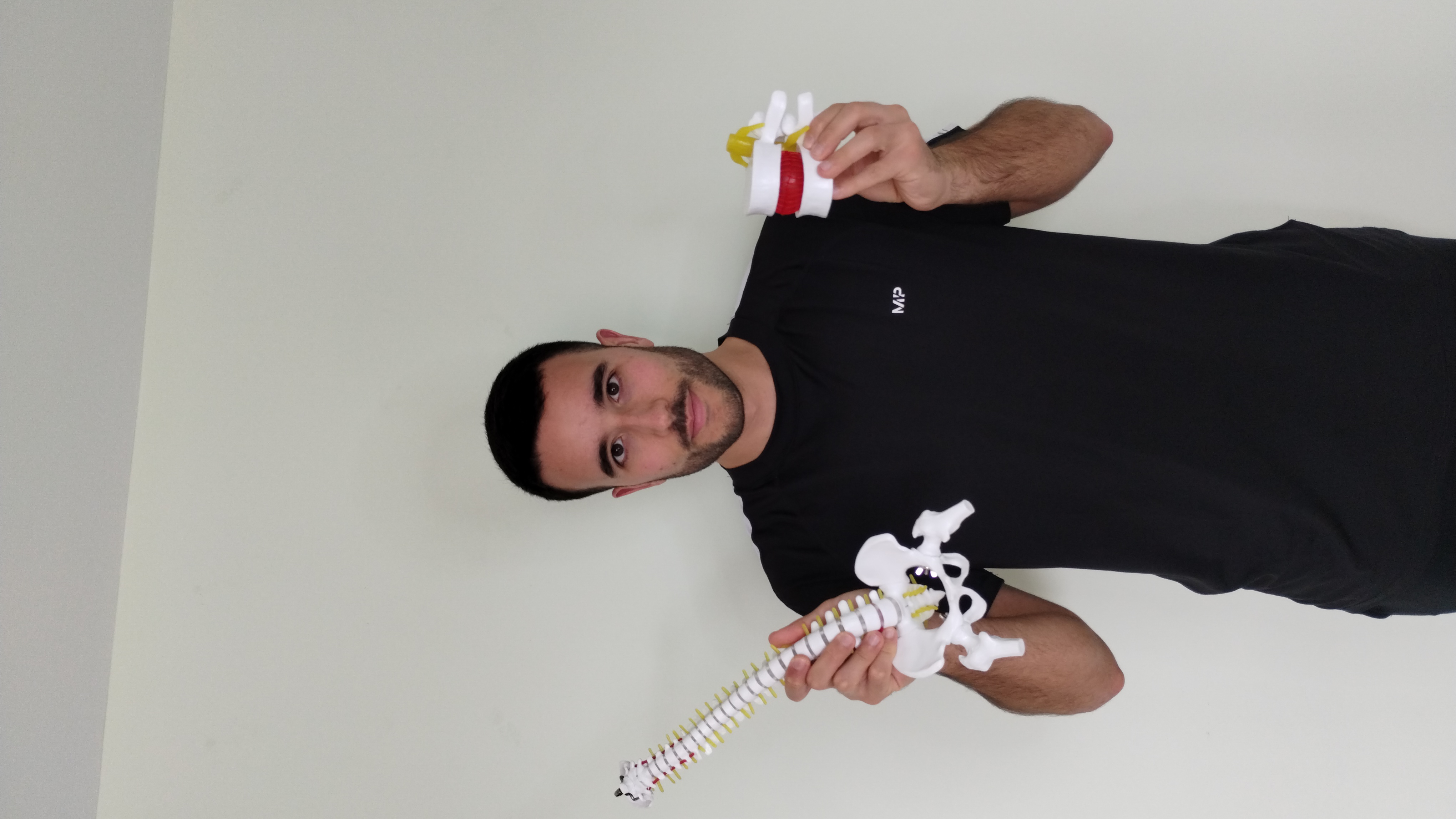 Jesús Espinosa - Fisioterapeuta especializado en hernias discales