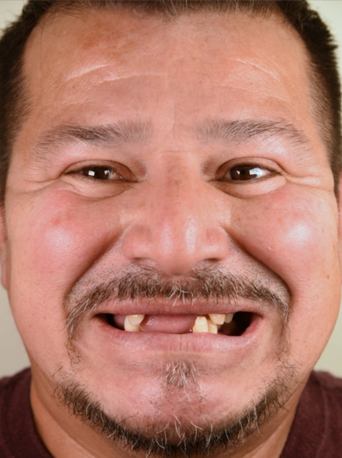 Before Smile 9