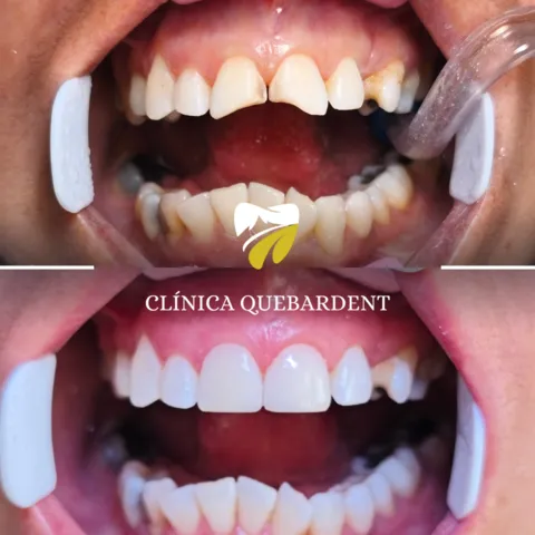 Paciente con sonrisa renovada