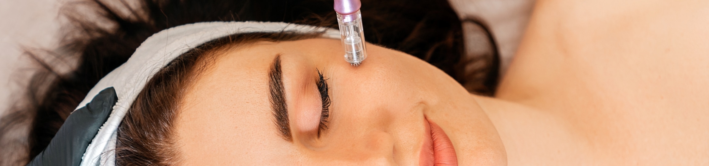 Discover the Aesthetic Benefits of Scarlet RF Microneedling Discover the Aesthetic Benefits of Scarlet RF Microneedling