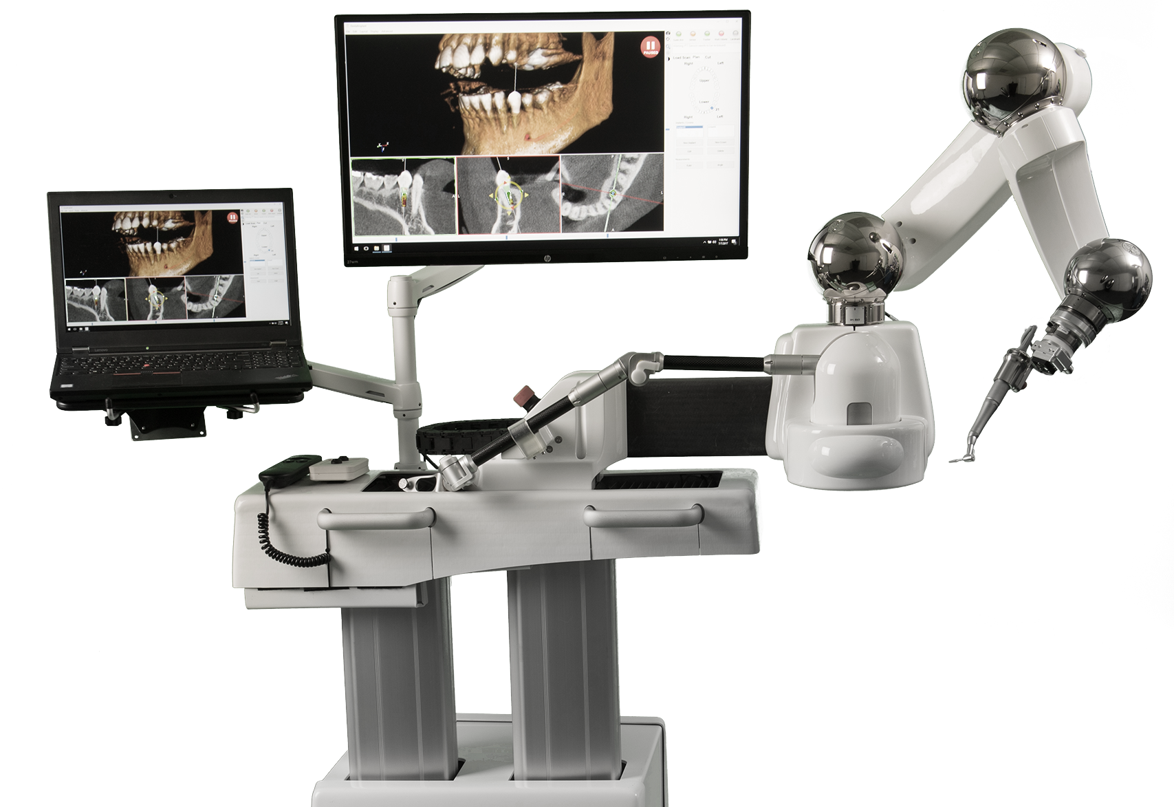 Robotic-Guided Dental Implants
