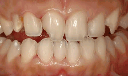 Cosmetic dentistry illustration