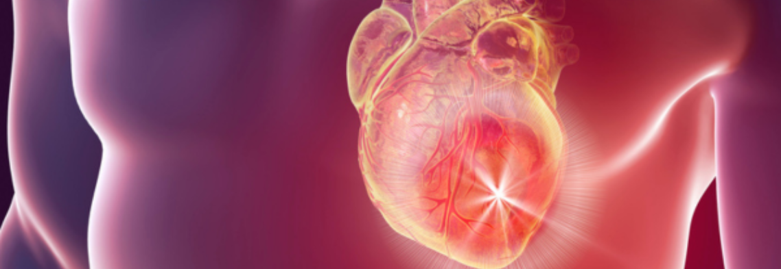 Heart attack prevention Heart attack prevention