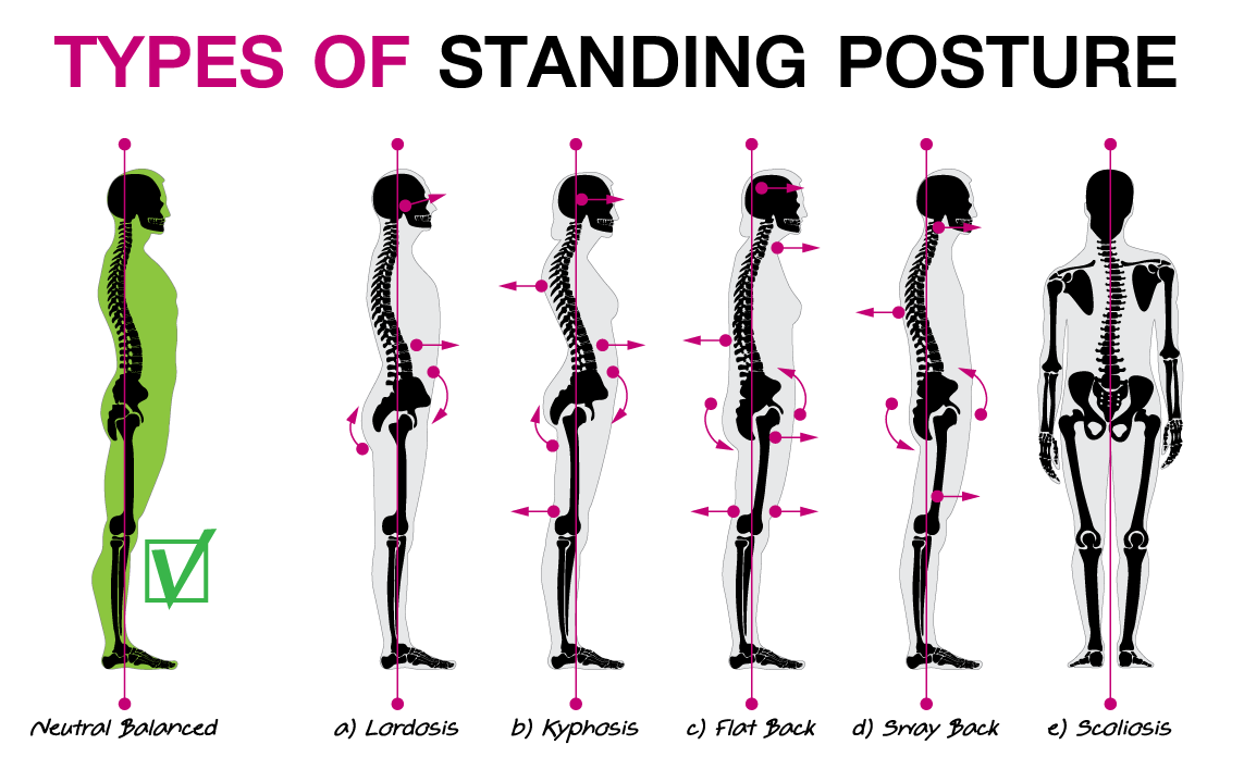 Nervous System Health and Posture Nervous System Health and Posture