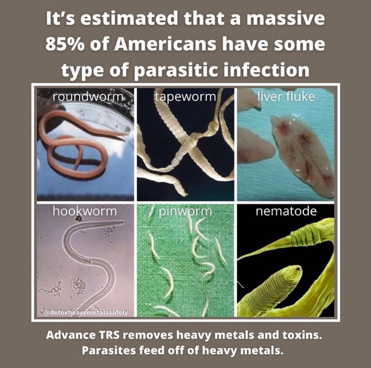 85% of Americans have some type of parasitic infection
