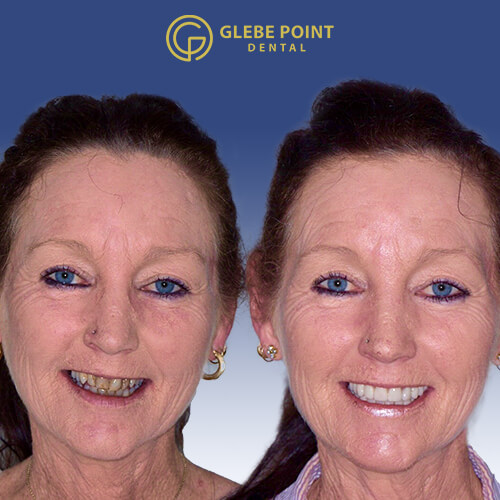 Before and after dental treatment showing improved teeth appearance 5