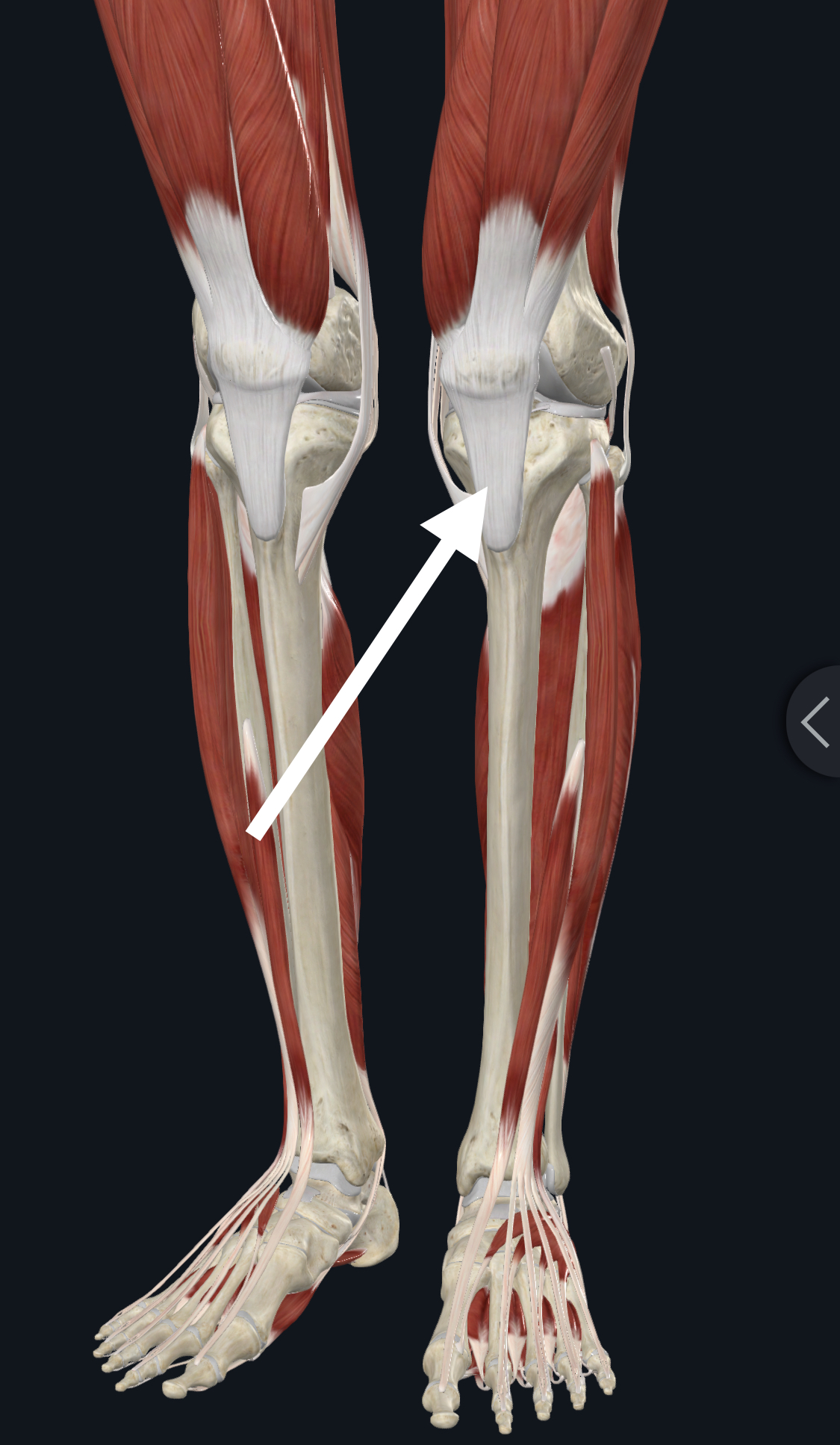 osgood schlatter disease Newbury 
