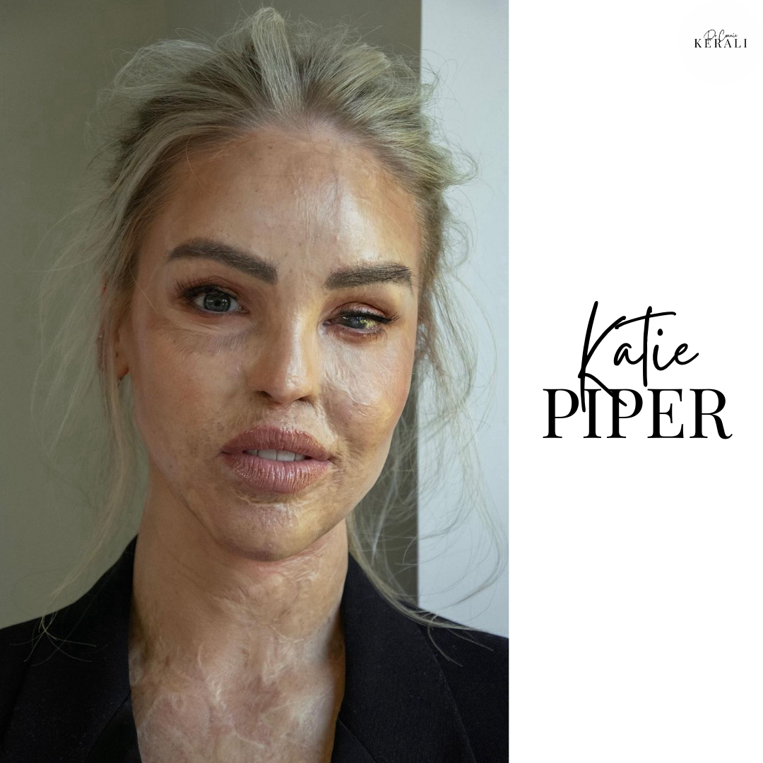 Image of Katie Piper Image of Katie Piper