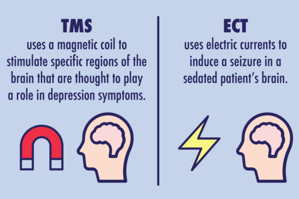 CGI of explanation of differences between ECT and TMS