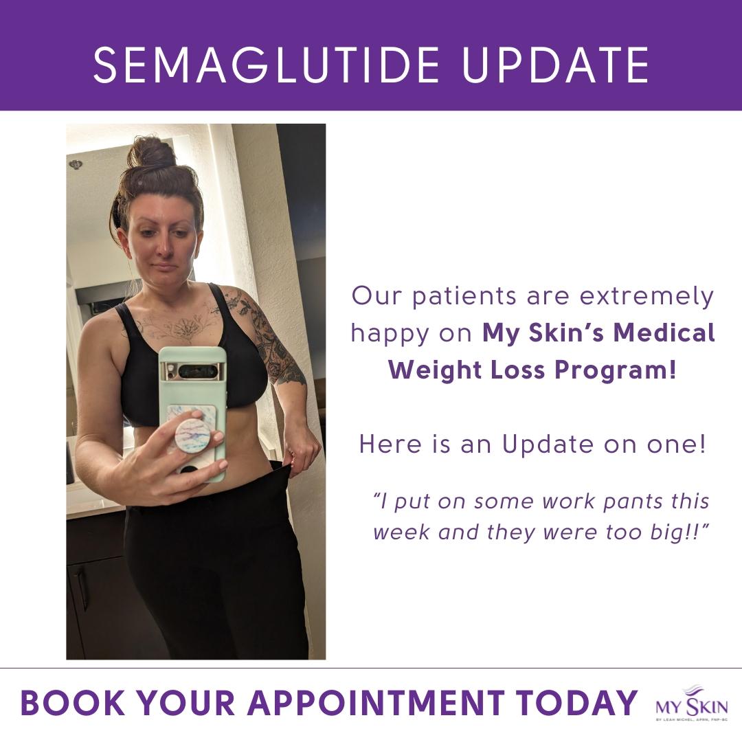Semaglutide in St. Petersburg, FL: Your Complete Guide to Medical Weight Loss at My Skin