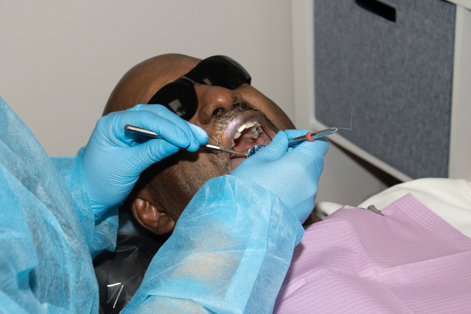 Fillings, Crowns & Bridges