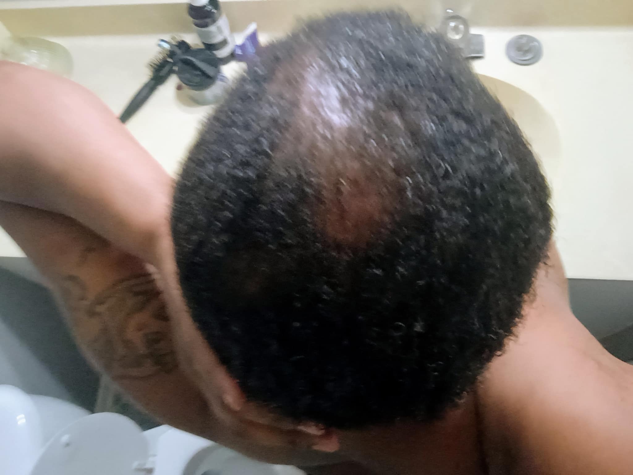 Before