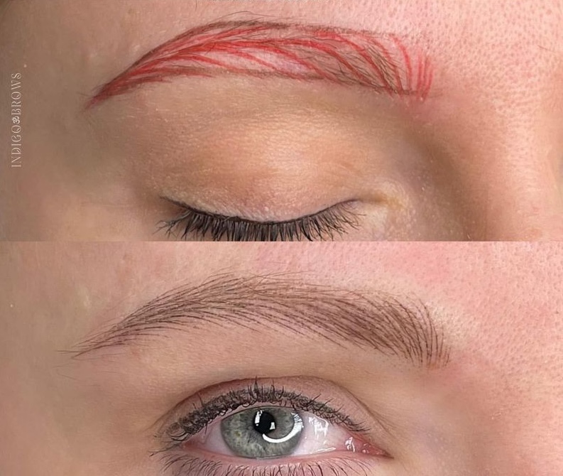 Spa Treatment Transformation