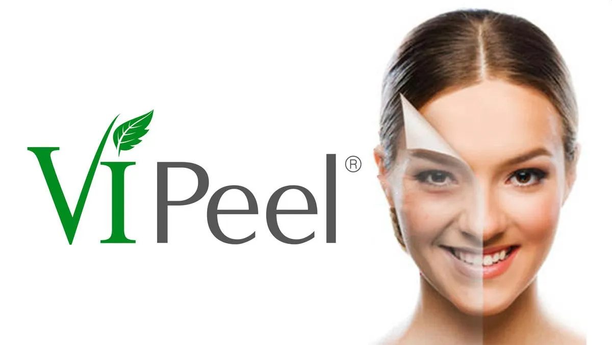 Chemical Peel 