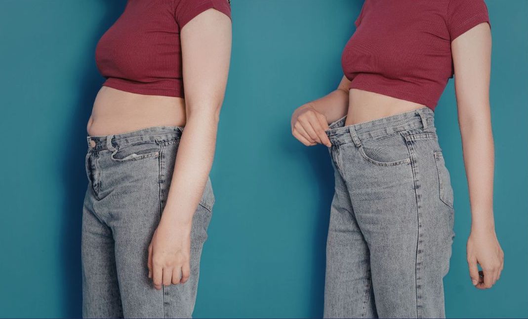 Patient transformation showing 24 lbs weight loss