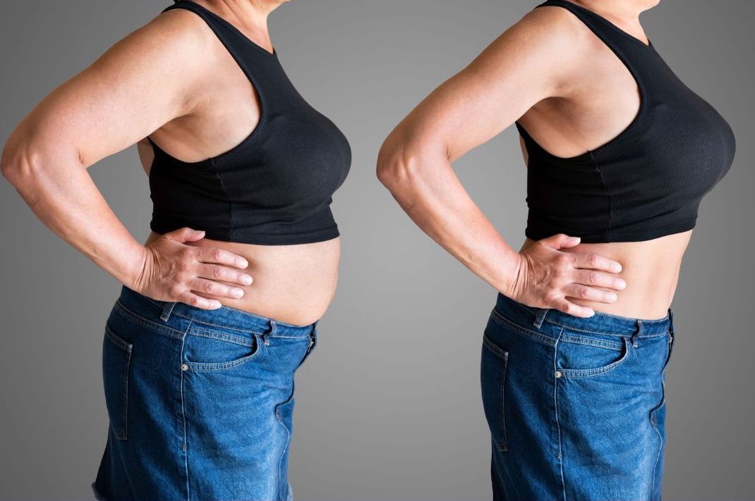 Patient transformation showing 27 lbs weight loss