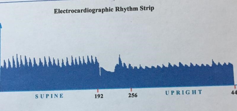 HRV good example