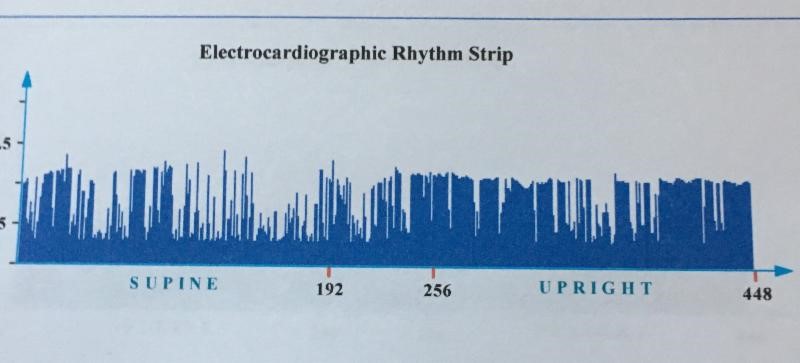 HRV bad example