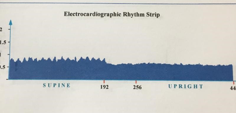 HRV patient after earthing