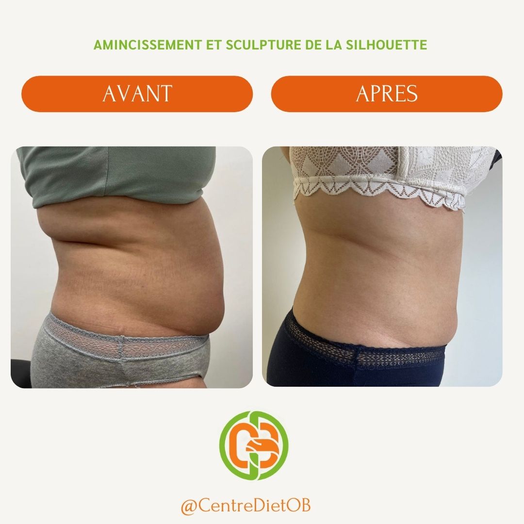 DietOB résultat 2