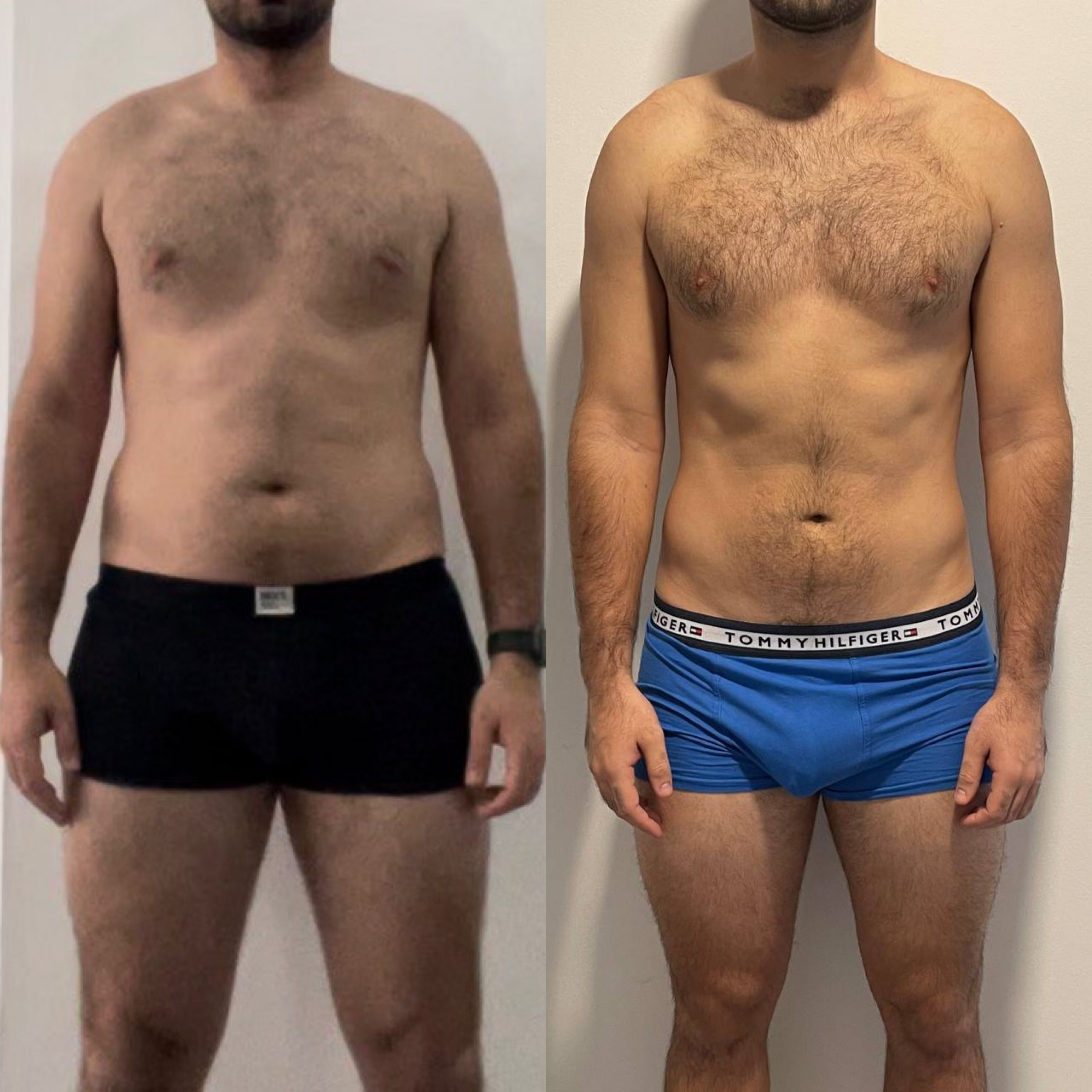 Resultado Antes y Después 2
