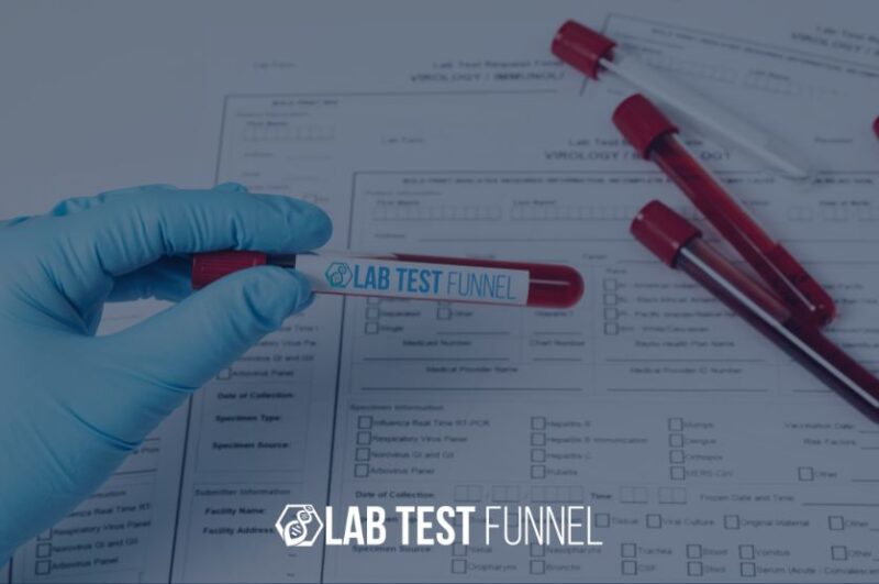 A close-up of a hand in a blue medical glove holding a blood sample vial labeled "Lab Test Funnel" over a lab requisition form, with other blood vials nearby.