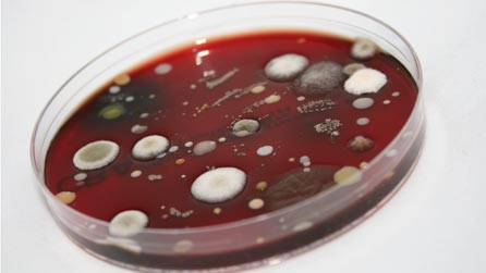Mold in petri dish