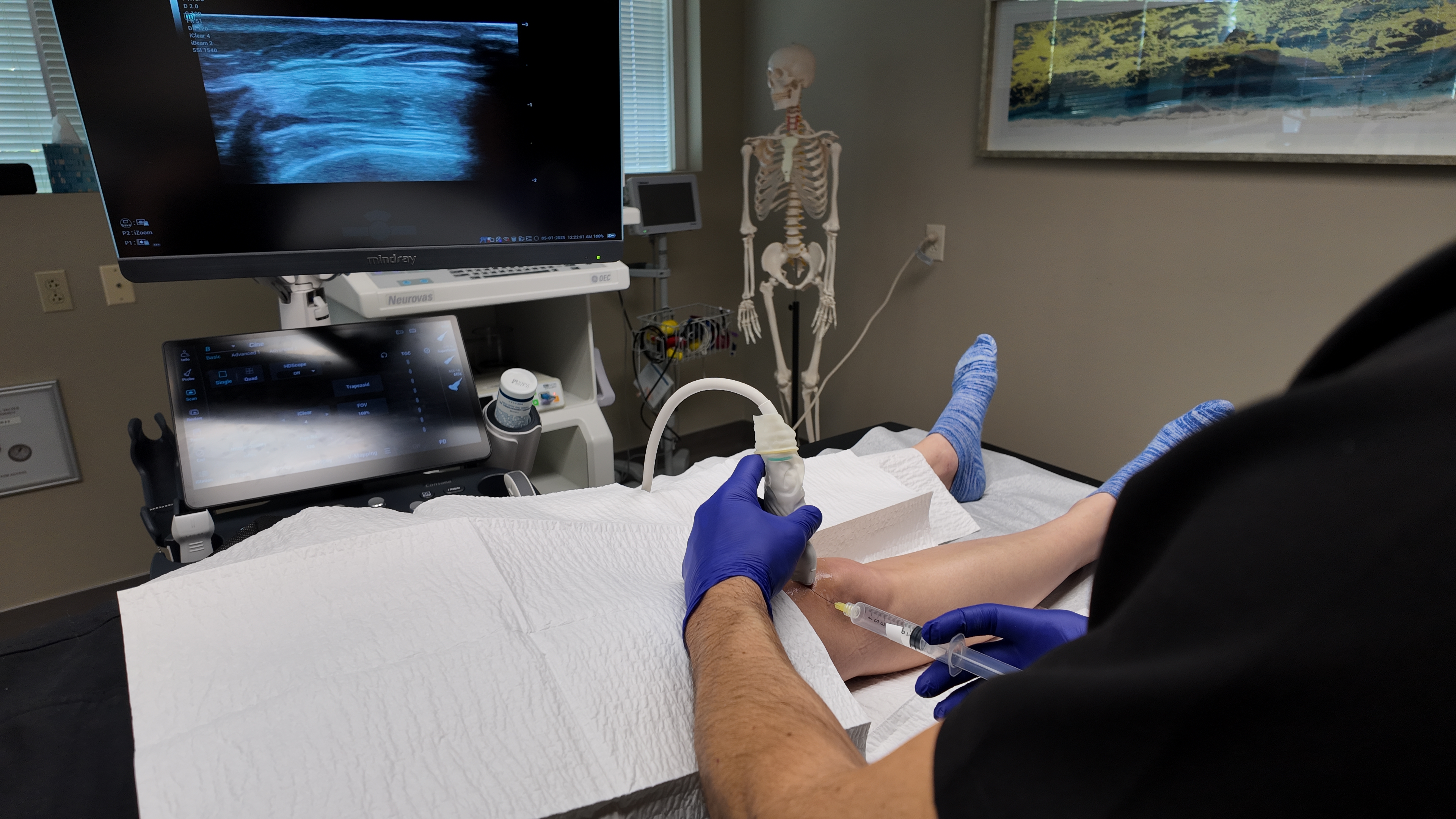 Ultrasound guided injection at IOW