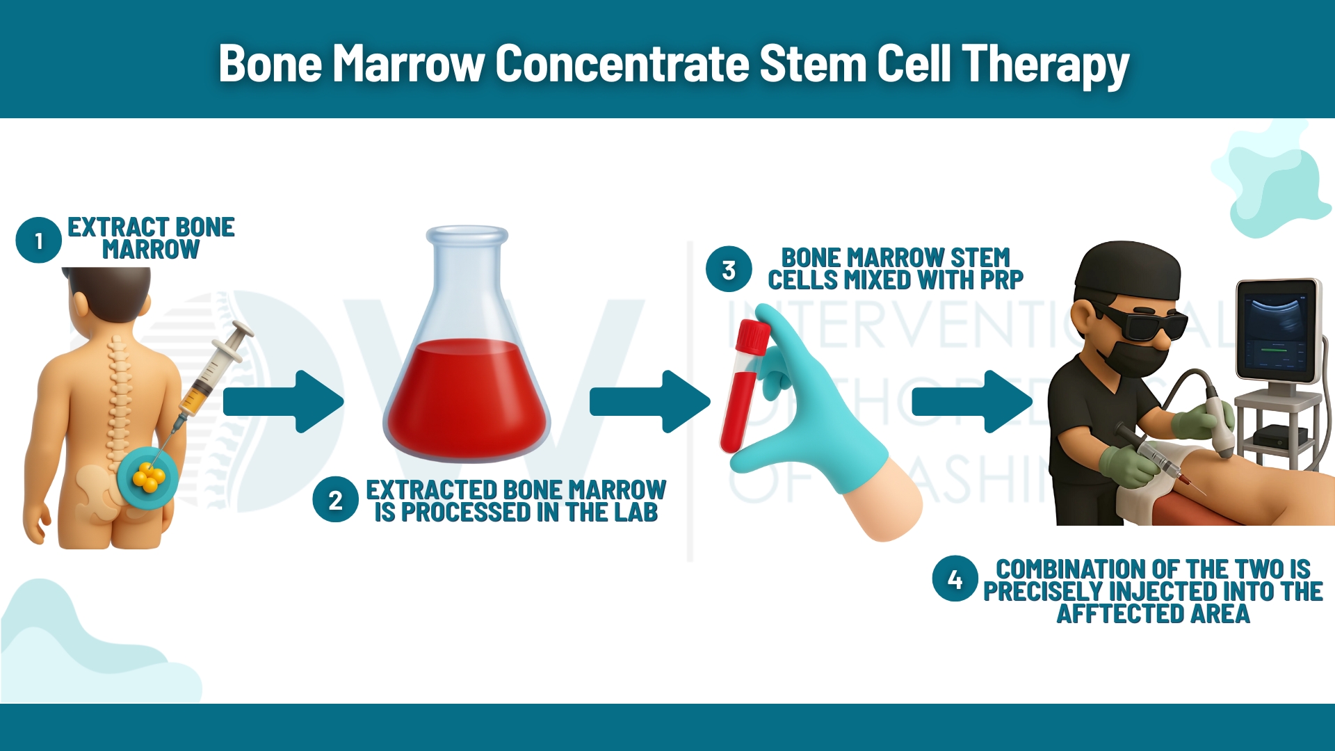 How (BMC) stem cell therapy is processed and performed at IOW to reduce inflammation and repair tissue of joint pain