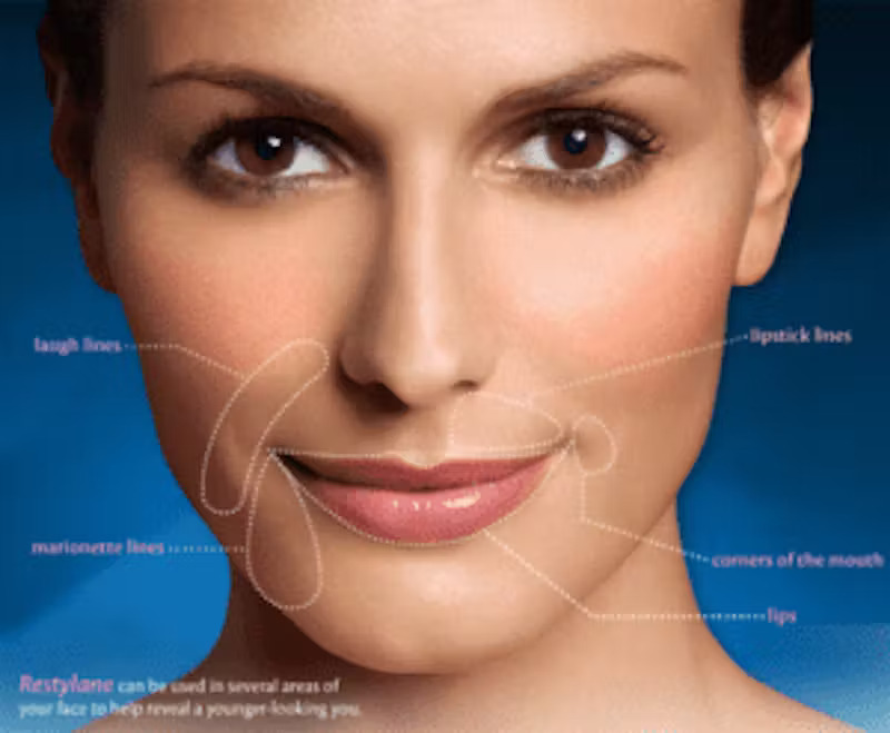 restylane-dermal-filler-cost-atlanta restylane-dermal-filler-cost-atlanta
