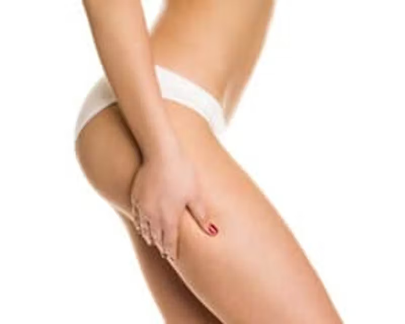smart-lipo smart-lipo