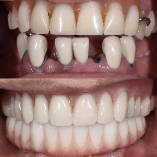 Risultato 1