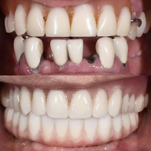 Risultato 5